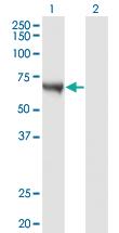 Anti-CAMKK1 Mouse Monoclonal Antibody [clone: 4B4]