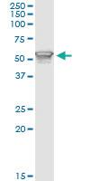 Anti-PIK3R1 Mouse Monoclonal Antibody