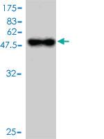 Anti-TNFRSF17 Mouse Monoclonal Antibody [clone: 1F10]