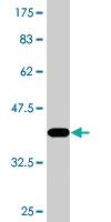 Anti-DSN1 Mouse Monoclonal Antibody [clone: 2A7]