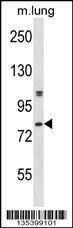 Anti-DYRK4 Rabbit Polyclonal Antibody (FITC (Fluorescein Isothiocyanate))