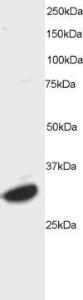 Anti-ATF7 Antibody (A83423) staining (0.5 µg/ml) of HeLa lysate (RIPA buffer, 35 µg total protein per lane). Primary incubated for 1 hour. Detected by western blot using chemiluminescence