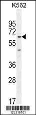 Anti-KLHL40 Rabbit Polyclonal Antibody