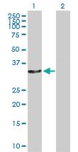 Anti-CAMLG Rabbit Polyclonal Antibody