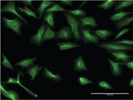 Anti-DCP1A Mouse Monoclonal Antibody [clone: 2F11]