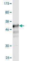 Anti-CD58 Mouse Monoclonal Antibody [clone: 3B12-D5]