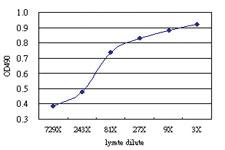 Anti-ACCS Antibody Pair