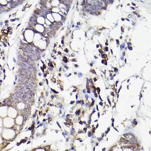 Immunohistochemistry analysis of paraffin-embedded human colon tissue using Anti-IL-6R Antibody (A8941) at a dilution of 1:50 (40x lens). Perform high pressure antigen retrieval with 10 mM citrate buffer pH 6.0 before commencing with IHC staining protocol