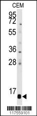 Anti-PFDN6 Rabbit Polyclonal Antibody