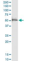 Anti-PTPN1 Rabbit Polyclonal Antibody