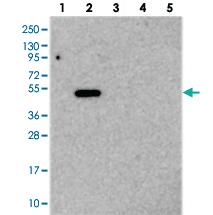 Anti-TMEM39A Rabbit Polyclonal Antibody