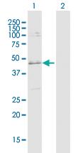 Anti-SLC25A31 Rabbit Polyclonal Antibody