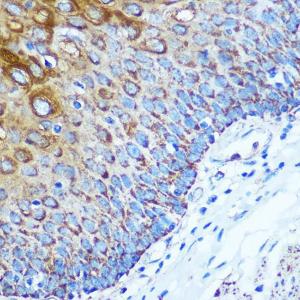 Immunohistochemistry analysis of paraffin-embedded human esophageal using Anti-KIBRA Antibody (A93147) at a dilution of 1:100 (40x lens). Perform microwave antigen retrieval with 10 mM PBS buffer pH 7.2 before commencing with IHC staining protocol.