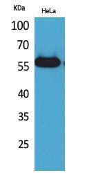 Anti-AMY1 and AMY2 antibody