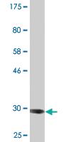 Anti-ADAM29 Mouse Monoclonal Antibody [clone: 3A6]