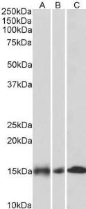 Anti-NDUFA7 Antibody (A85062) (0.1 µg/ml) staining of Human (A), Mouse (B) and Rat (C) Heart lysates (35 µg protein in RIPA buffer). Primary incubation was 1 hour. Detected by chemiluminescence