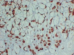 Immunohistochemical analysis of paraffin-embedded human Salivary gland using Anti-GCDFP 15 Antibody