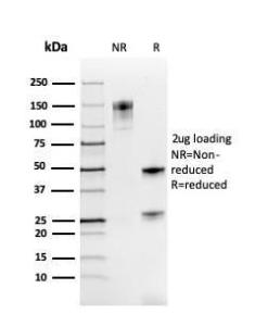 SDS-PAGE analysis of Anti-PAX8 Antibody [rPAX8/3687] under non-reduced and reduced conditions; showing intact IgG and intact heavy and light chains, respectively. SDS-PAGE analysis confirms the integrity and purity of the antibody