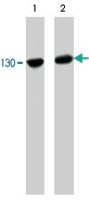 Anti-CDH2 Mouse Monoclonal Antibody [clone: M170]