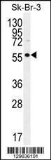 Anti-LOC129293 Rabbit Polyclonal Antibody (Biotin)