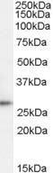 Anti-TPD52 Antibody (A83425) (1µg/ml) staining of Human Lymph Node lysate (35µg protein in RIPA buffer). Detected by chemiluminescence.