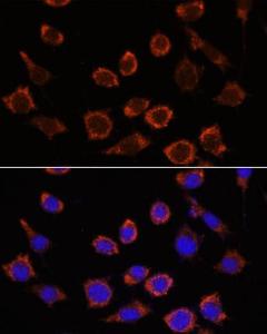 Immunofluorescence analysis of L929 cells using Anti-RPL35 Antibody (A309114) at a dilution of 1:100. DAPI was used to stain the cell nuclei (blue)