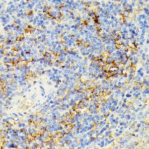 Immunohistochemistry analysis of paraffin-embedded rat spleen using Anti-ECE1 Antibody (A305292) at a dilution of 1:100 (40x lens). Perform microwave antigen retrieval with 10 mM PBS buffer pH 7.2 before commencing with IHC staining protocol.