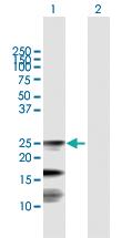 Anti-FXN Rabbit Polyclonal Antibody