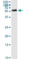 Anti-ACCS Polyclonal Antibody Pair