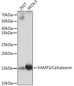 Western blot analysis of extracts of various cell lines, using Anti-Cellubrevin Antibody [ARC1312] (A307871) at 1:1,000 dilution. The secondary antibody was Goat Anti-Rabbit IgG H&L Antibody (HRP) at 1:10,000 dilution.