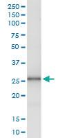 Anti-FXN Rabbit Polyclonal Antibody