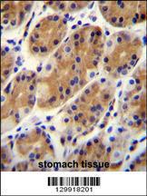 Anti-CCDC153 Rabbit Polyclonal Antibody (AP (Alkaline Phosphatase))