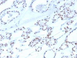 Immunohistochemical analysis of formalin-fixed, paraffin-embedded human thyroid using Anti-PAX8 Antibody [rPAX8/3687]