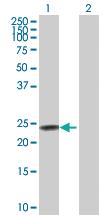 Anti-FXN Rabbit Polyclonal Antibody