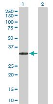 Anti-PRRX2 Rabbit Polyclonal Antibody