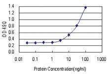 Anti-GSTA3 Antibody Pair