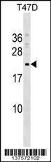 Anti-COMMD9 Rabbit Polyclonal Antibody (Biotin)