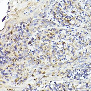 Immunohistochemistry analysis of paraffin-embedded human tonsil using Anti-IL-6R Antibody (A8941) at a dilution of 1:50 (40x lens). Perform high pressure antigen retrieval with 10 mM citrate buffer pH 6.0 before commencing with IHC staining protocol