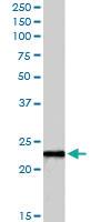 Anti-LCN2 Goat Polyclonal Antibody