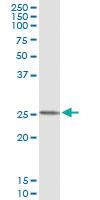 Anti-FXN Mouse Monoclonal Antibody [clone: 1D9]