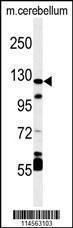 Anti-HIF1A Rabbit Polyclonal Antibody