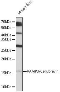 Western blot analysis of extracts of Mouse liver, using Anti-Cellubrevin Antibody [ARC1312] (A307871) at 1:1,000 dilution. The secondary antibody was Goat Anti-Rabbit IgG H&L Antibody (HRP) at 1:10,000 dilution.