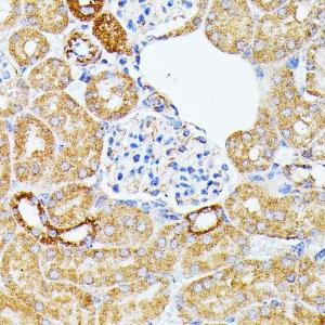 Immunohistochemistry analysis of paraffin-embedded mouse kidney using Anti-ECE1 Antibody (A305292) at a dilution of 1:100 (40x lens). Perform microwave antigen retrieval with 10 mM PBS buffer pH 7.2 before commencing with IHC staining protocol.