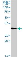 Anti-PRRX2 Rabbit Polyclonal Antibody