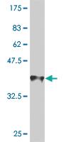 Anti-AMELX Mouse Monoclonal Antibody [clone: 5B2]