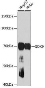 Western blot analysis of extracts of various cell lines, using Anti-SOX9 Antibody [ARC0190] (A306215) at 1:1000 dilution