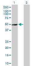 Anti-PTPN2 Rabbit Polyclonal Antibody