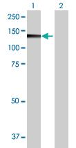 Anti-PMFBP1 Mouse Polyclonal Antibody