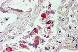 Anti-CES1 Antibody (A83426) (2.5µg/ml) staining of paraffin embedded Human Lung. Steamed antigen retrieval with citrate buffer pH 6, AP-staining.