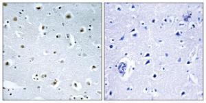 Immunohistochemical analysis of paraffin-embedded human brain tissue using Anti-TUBGCP3 Antibody. The right hand panel represents a negative control, where the Antibody was pre-incubated with the immunising peptide